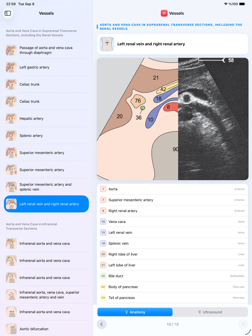 iPad screenshot 1