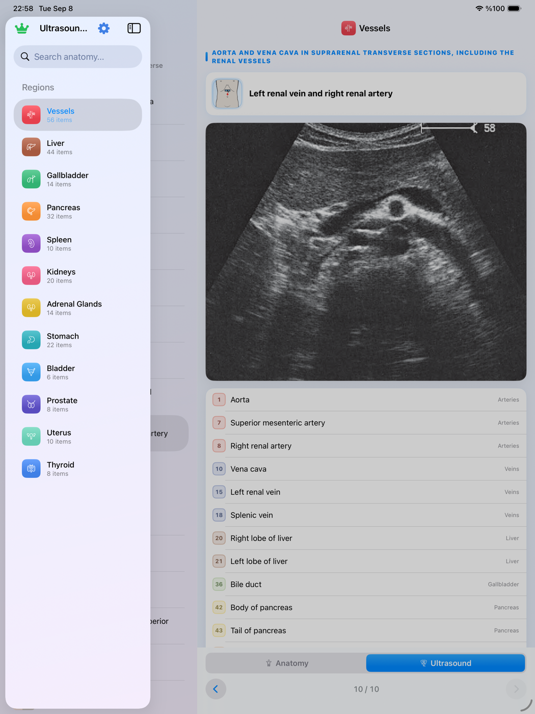 iPad screenshot 2