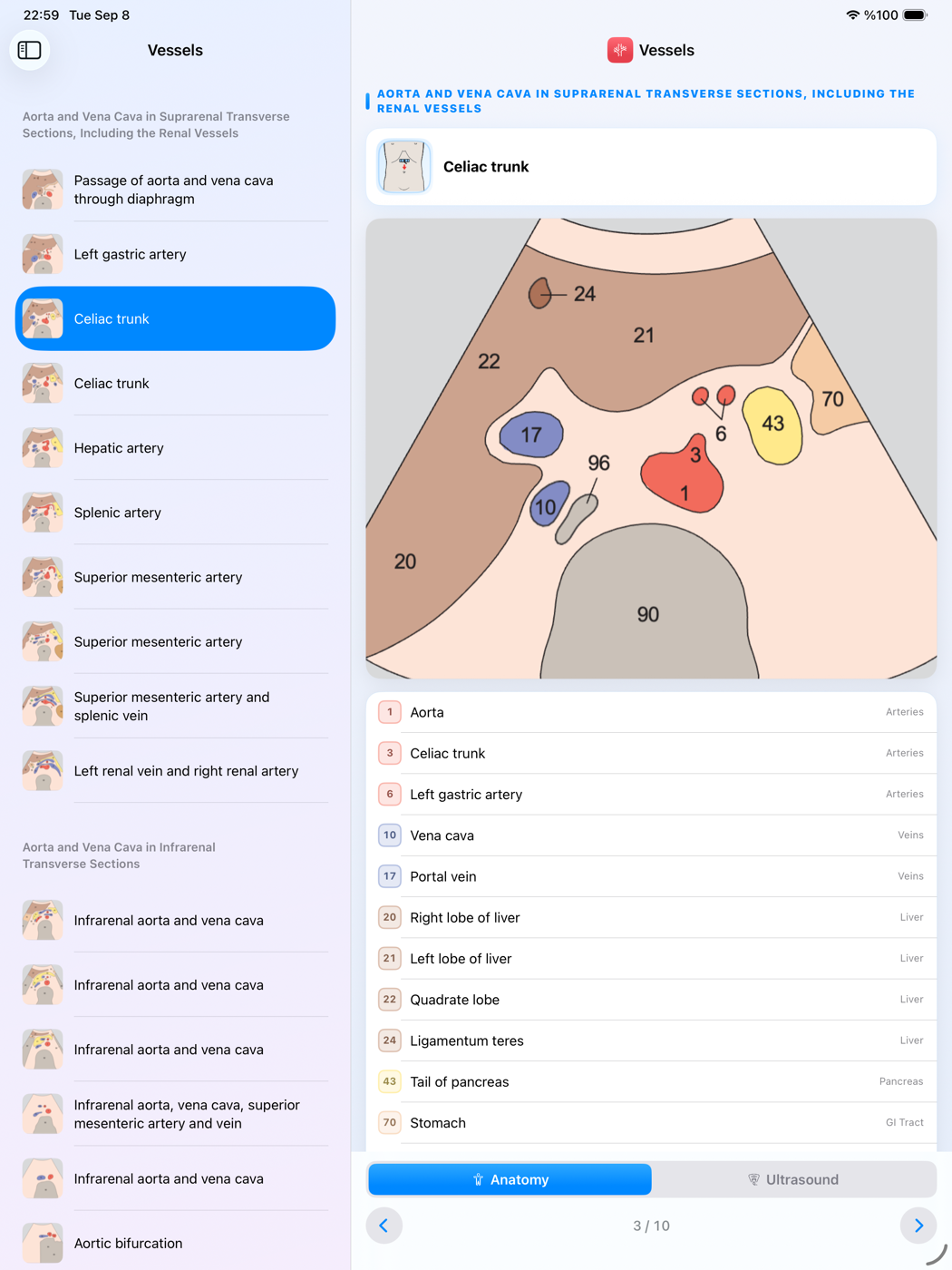 iPad screenshot 3
