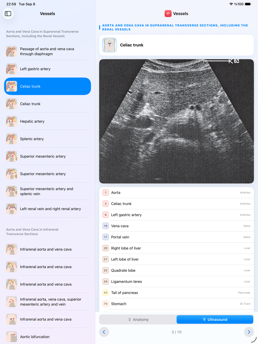 iPad screenshot 4