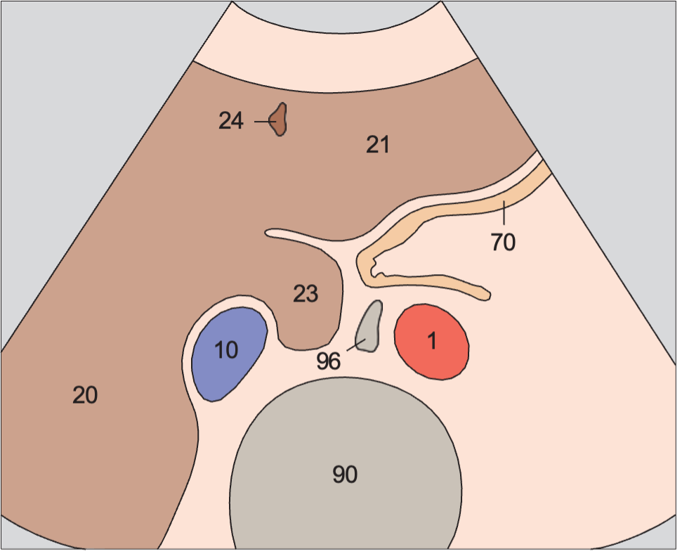 Caudate lobe anatomy diagram, Passage of aorta and vena cava through diaphragm