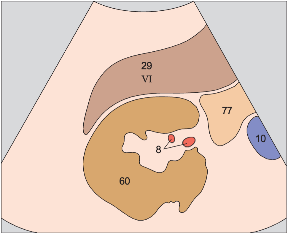 Posterior segment anatomy diagram, Posterior segment, inferior border