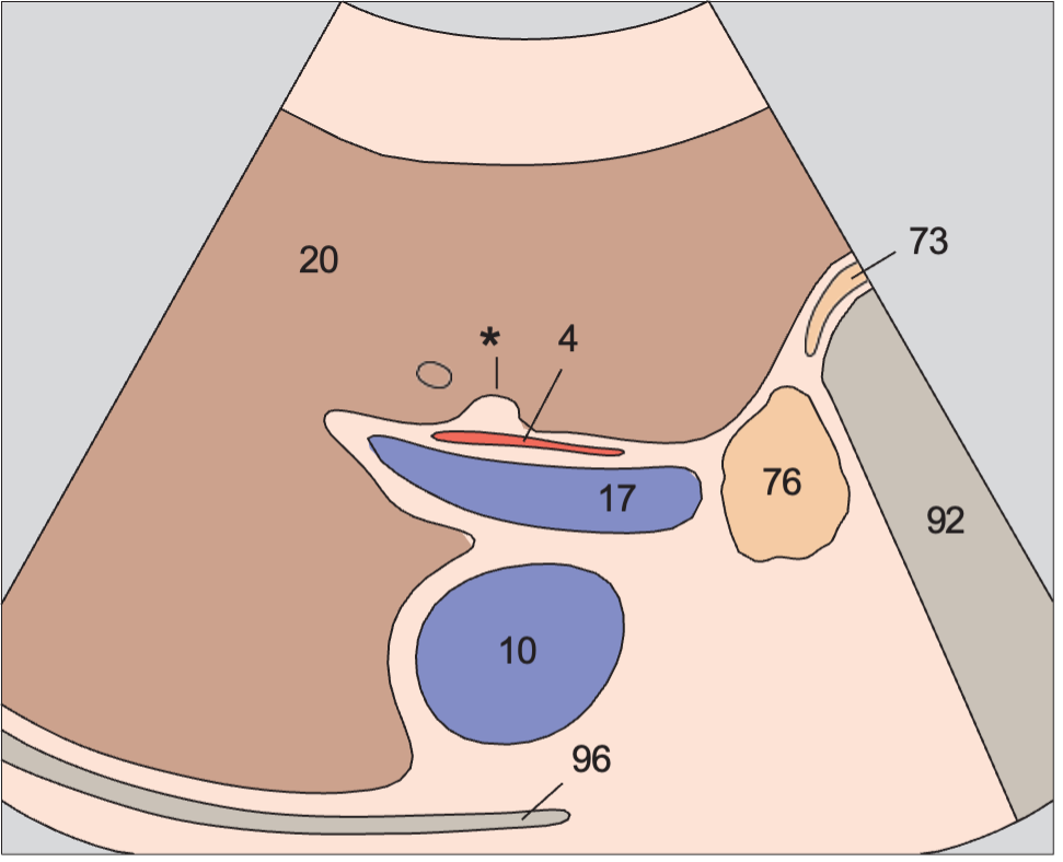 Duodenum anatomy diagram, Right portal vein branch, ligamentum venosum