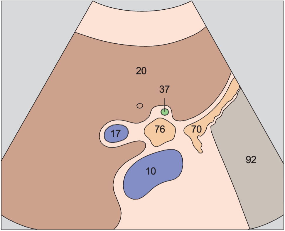 Duodenum anatomy diagram, Gallbladder neck