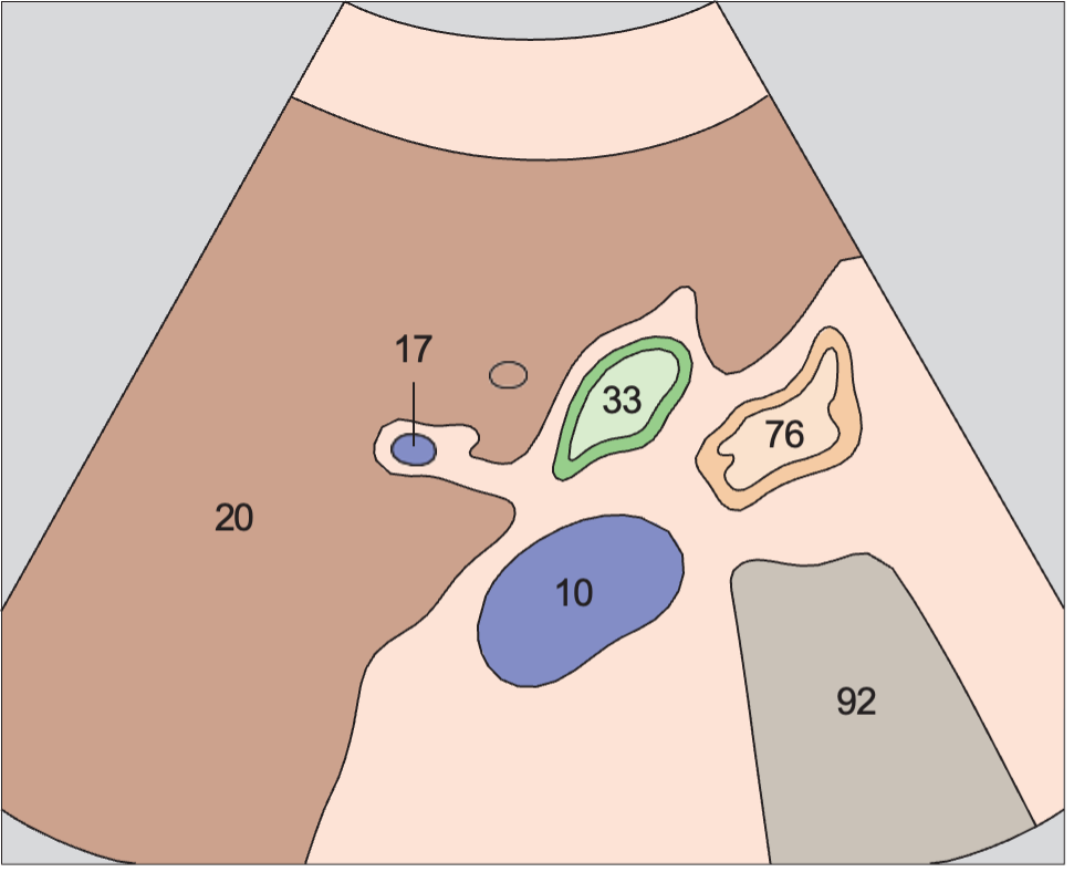 Duodenum anatomy diagram, Junction of neck and body of gallbladder