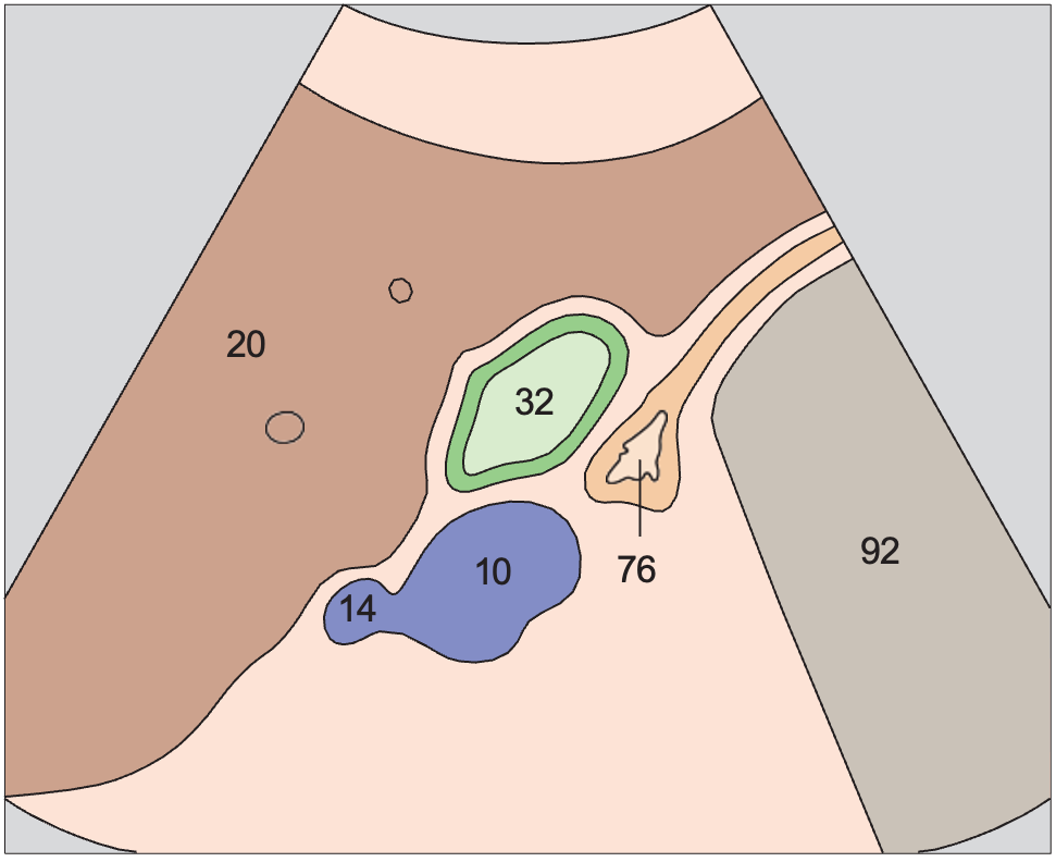 Duodenum anatomy diagram, Body of gallbladder