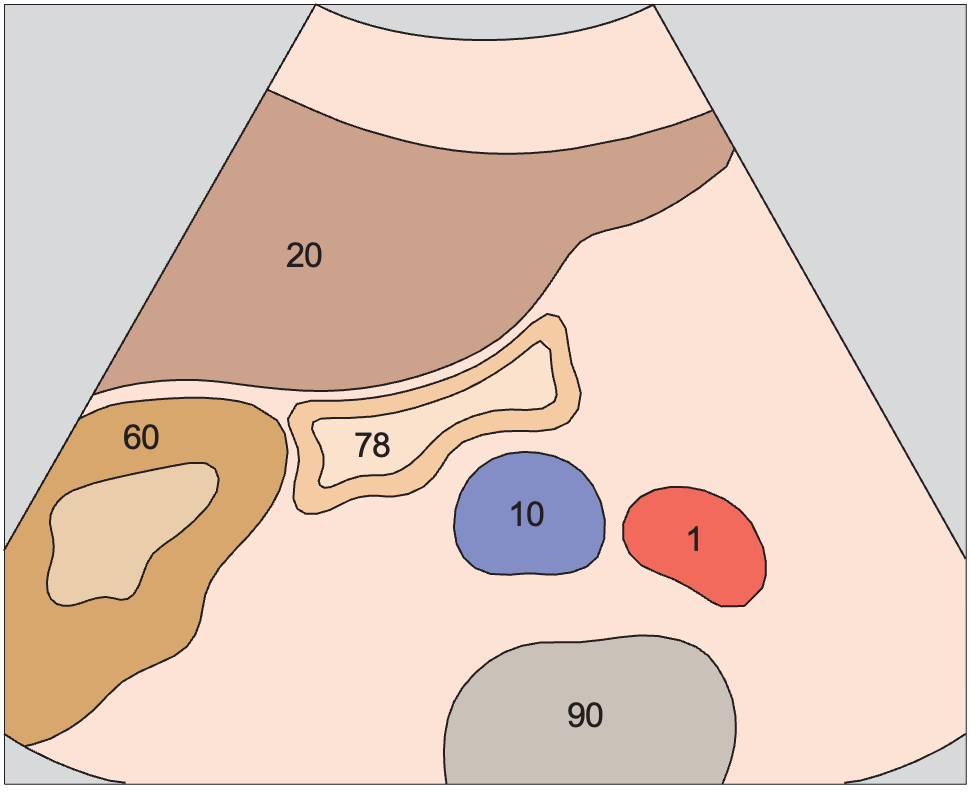 Right kidney anatomy diagram, Gallbladder fundus, inferior border