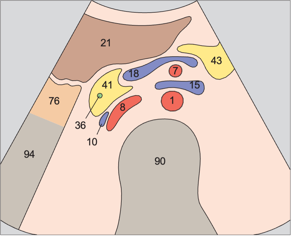 Duodenum anatomy diagram, Infrarenal aorta and vena cava