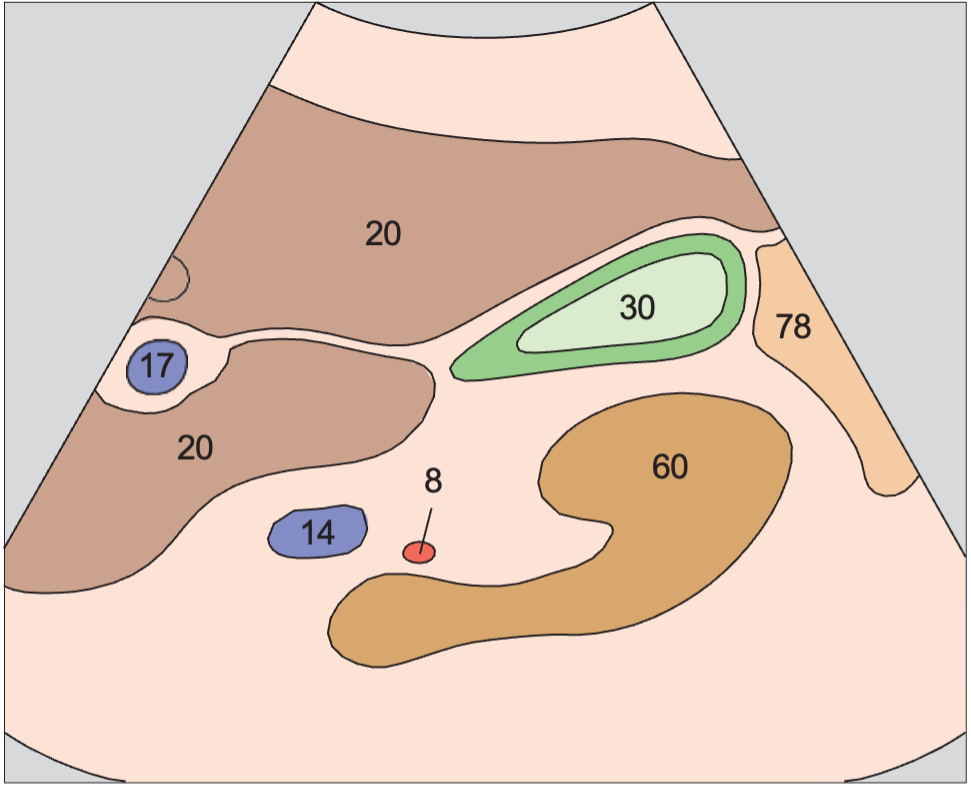 Gallbladder anatomy diagram, Body and fundus of gallbladder, kidney
