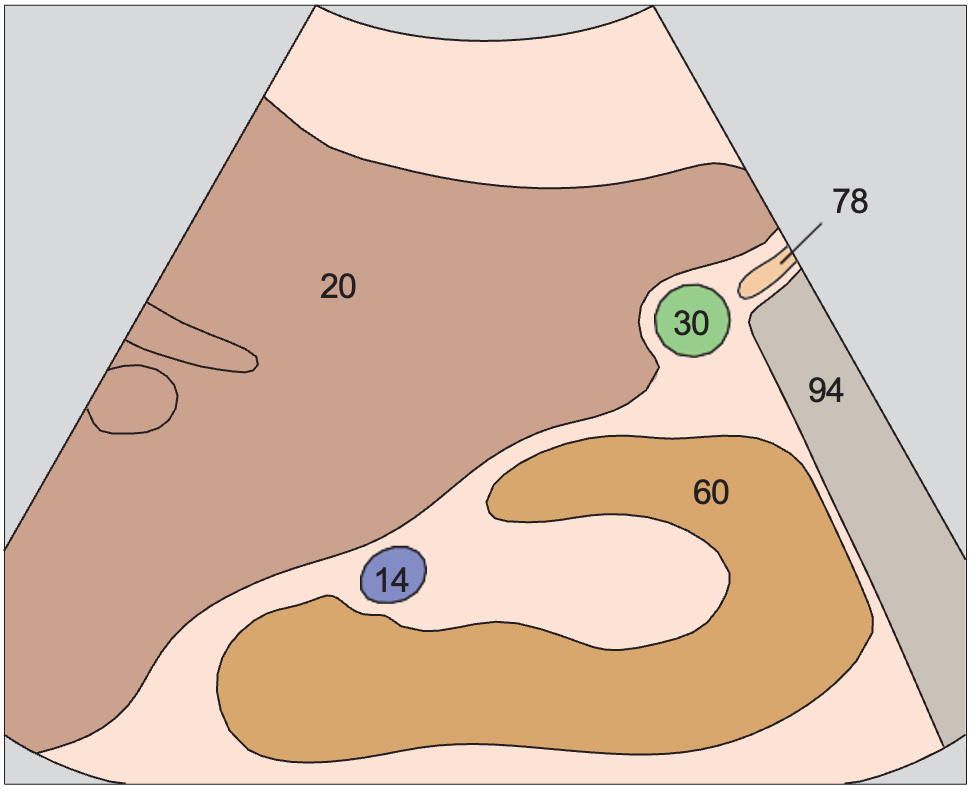 Gallbladder anatomy diagram, Gallbladder fundus, kidney
