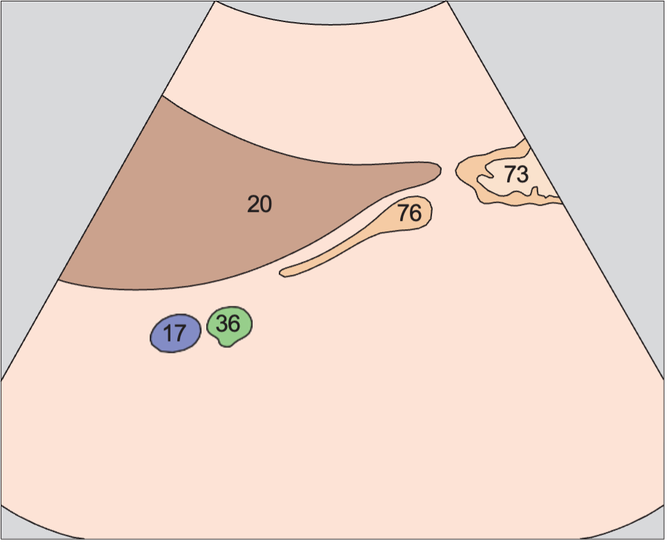 Duodenum anatomy diagram, Duodenum lateral to head of pancreas