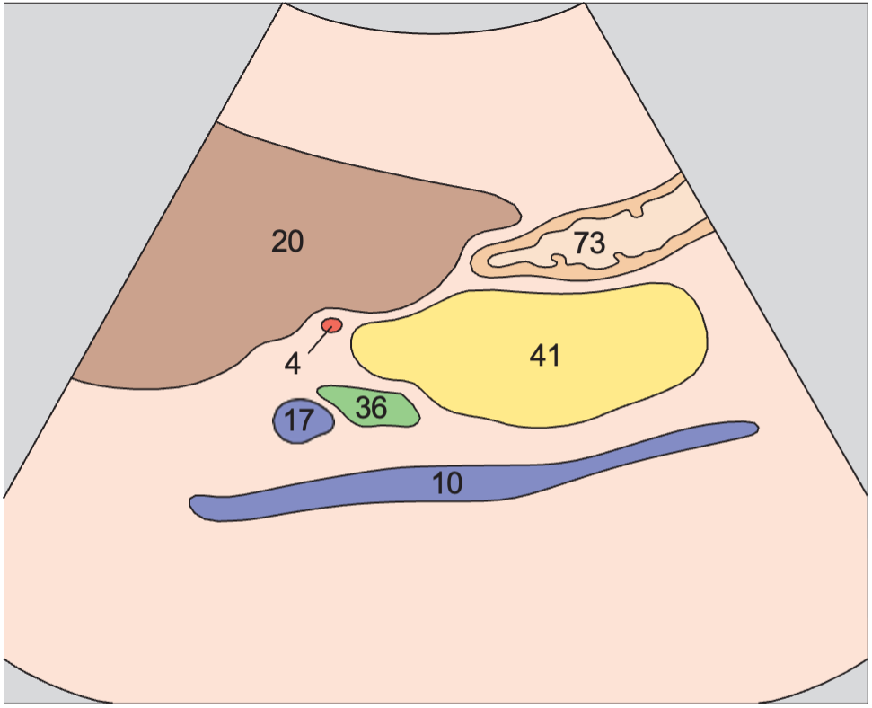Hepatic artery anatomy diagram, Head of pancreas, bile duct