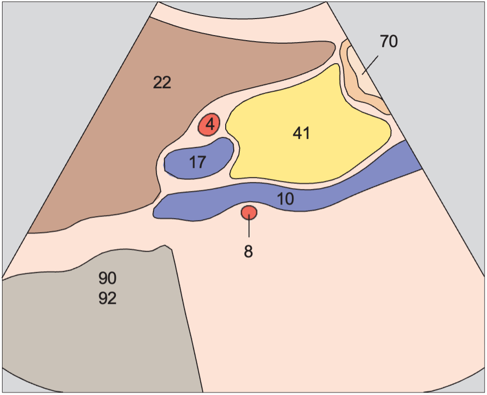 Acoustic shadow anatomy diagram, Head of pancreas, hilar vessels, vena cava