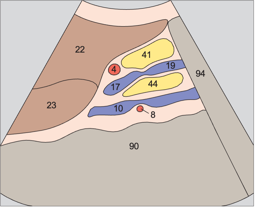 Uncinate process anatomy diagram, Head of pancreas, superior mesenteric vein, uncinate process
