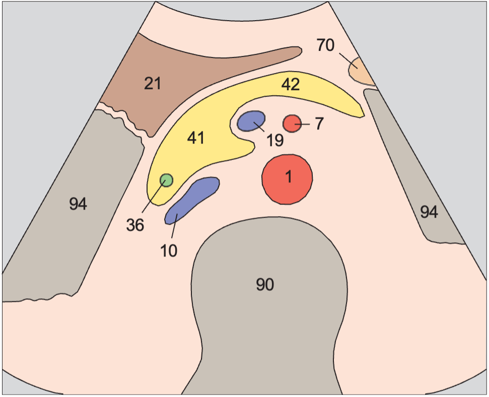 Stomach anatomy diagram, Infrarenal aorta and vena cava