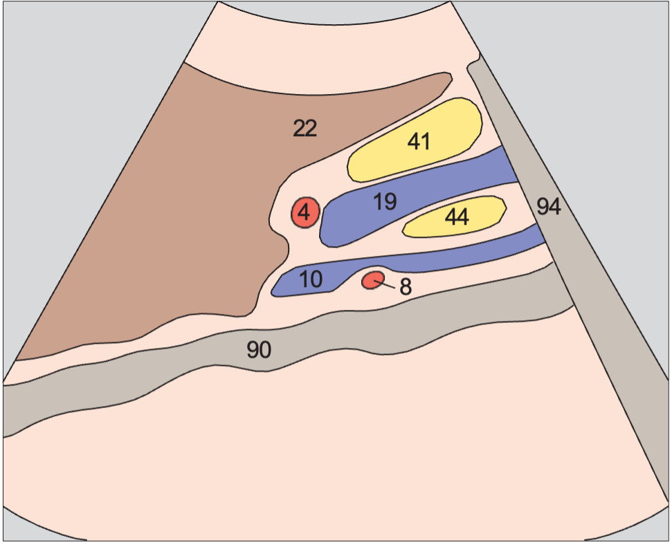 Uncinate process anatomy diagram, Head of pancreas, superior mesenteric vein, uncinate process