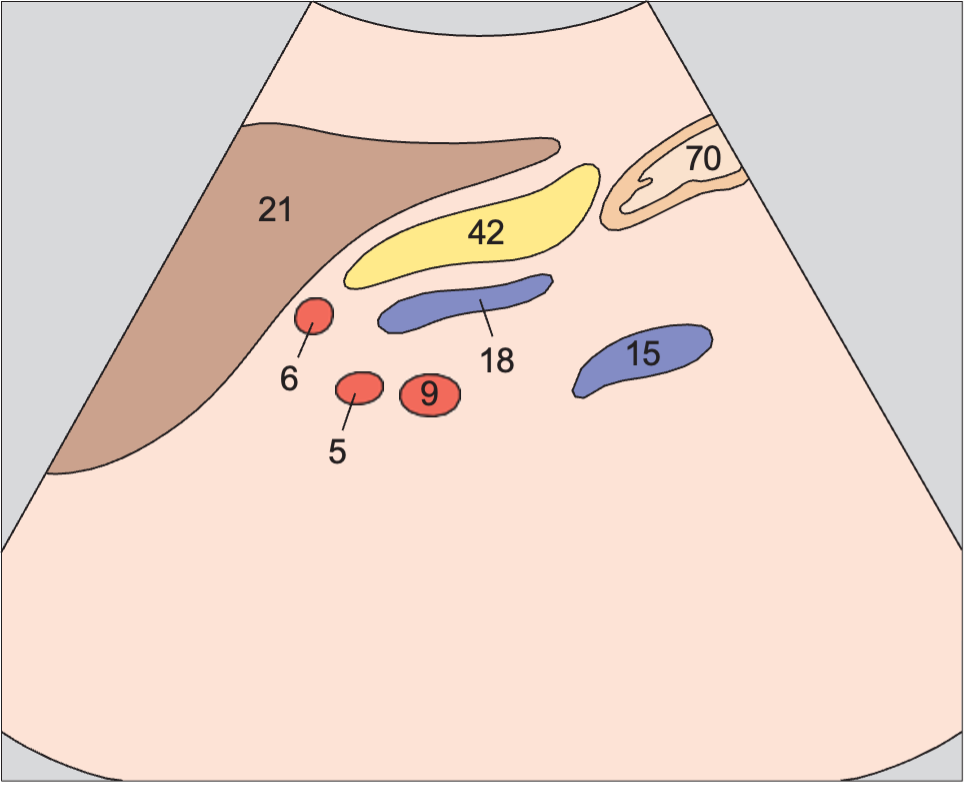 Stomach anatomy diagram, Body of pancreas, splenic vein