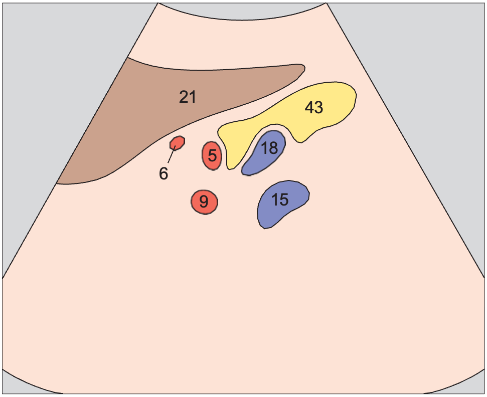 Left renal artery anatomy diagram, Tail of pancreas, splenic artery and vein, renal artery and vein