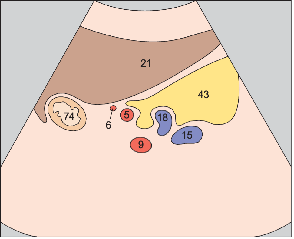 Left renal artery anatomy diagram, Tail of pancreas, splenic artery and vein, renal artery and vein