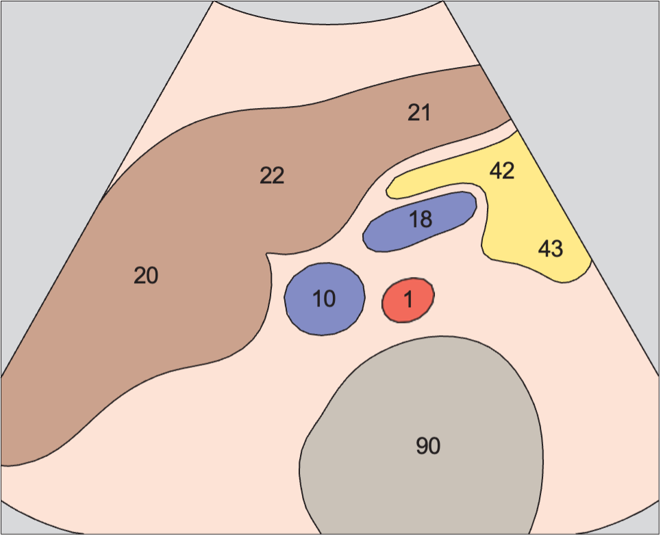 Quadrate lobe anatomy diagram, Section cranial to head of pancreas, vena cava, splenic vein