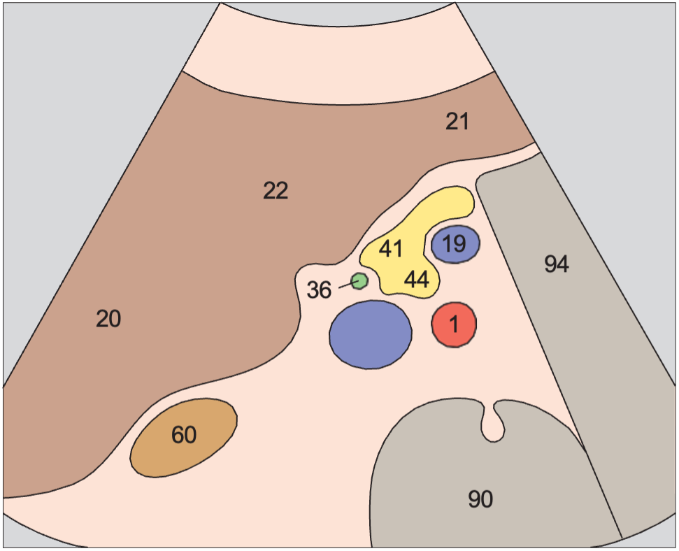 Uncinate process anatomy diagram, Head of pancreas, vena cava, superior mesenteric vein