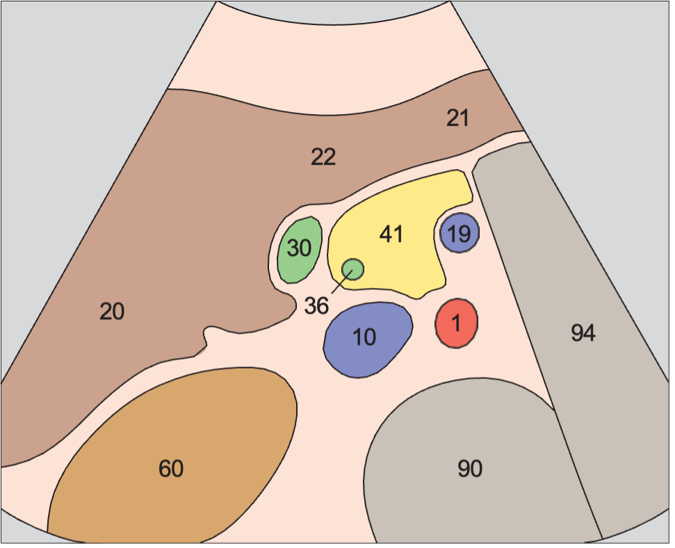 Gallbladder anatomy diagram, Head of pancreas, vena cava, superior mesenteric vein, uncinate process, common bile duct