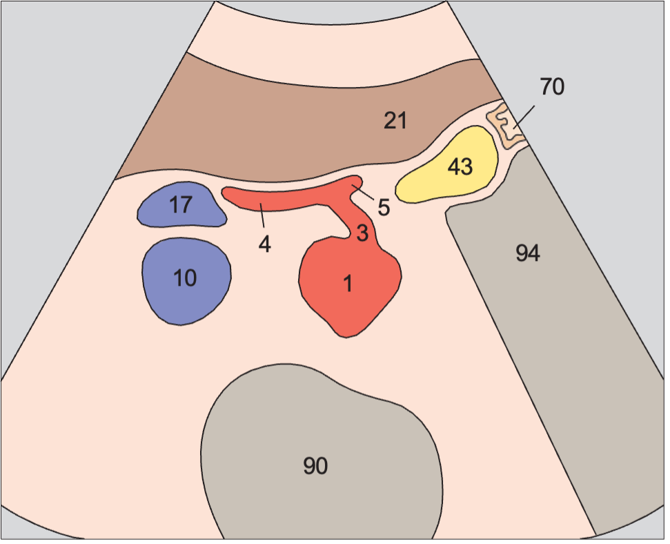 Stomach anatomy diagram, Scan cranial to body of pancreas, celiac trunk