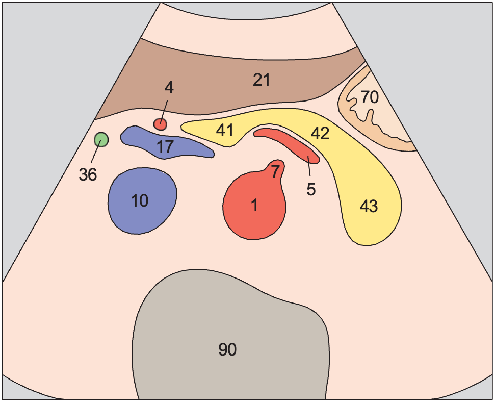 Stomach anatomy diagram, Body of pancreas, splenic vein
