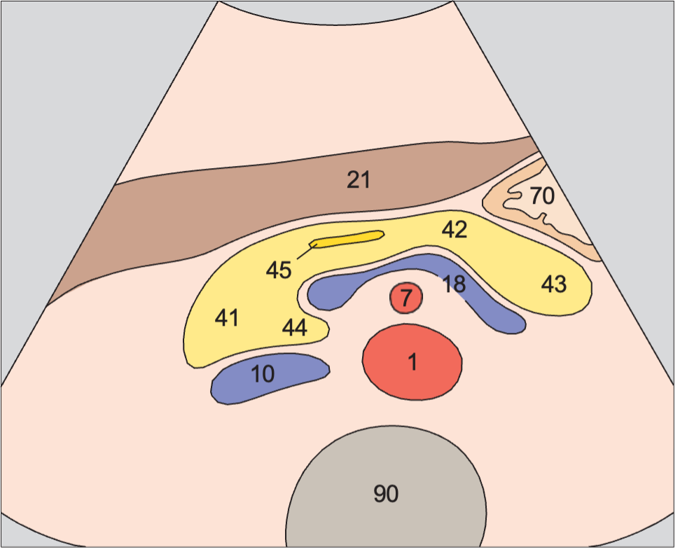 Uncinate process anatomy diagram, Body of pancreas, splenic vein, superior mesenteric artery, aorta