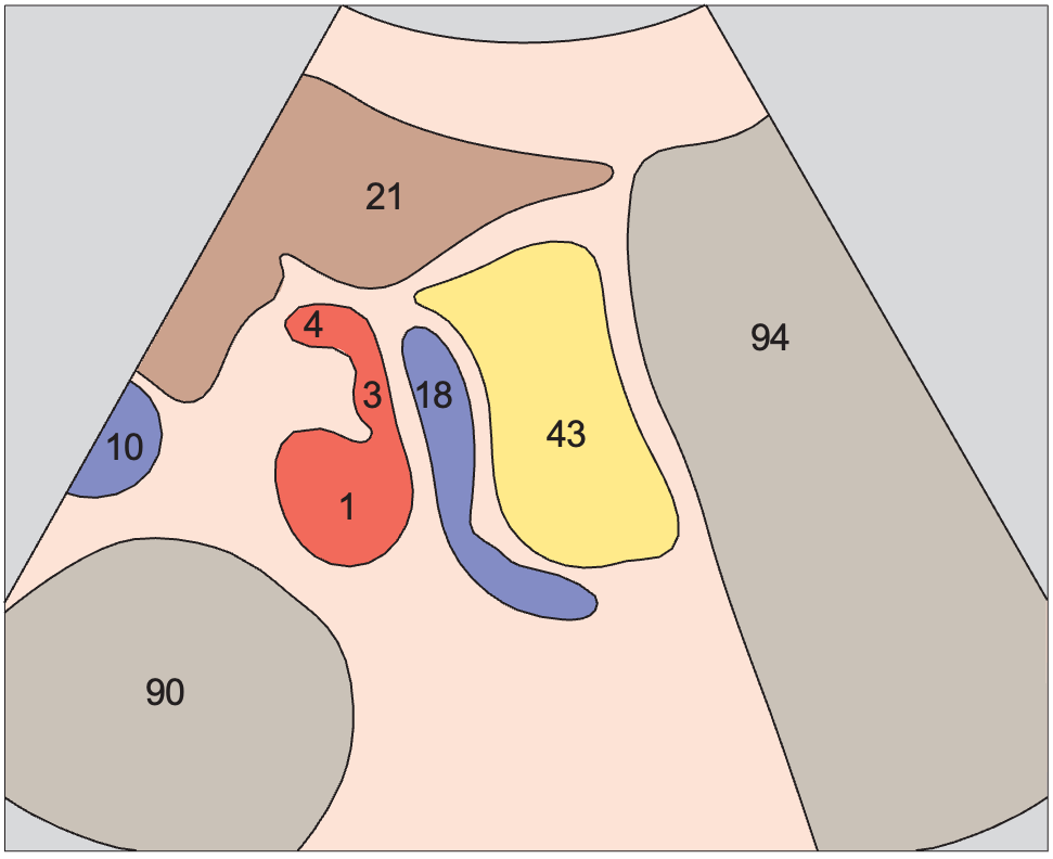 Artifact anatomy diagram, Tail of pancreas, splenic vein