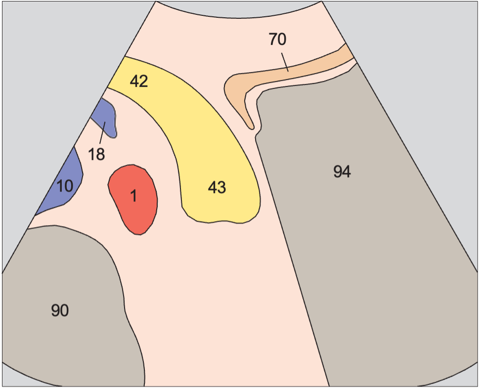 Stomach anatomy diagram, Tail of pancreas