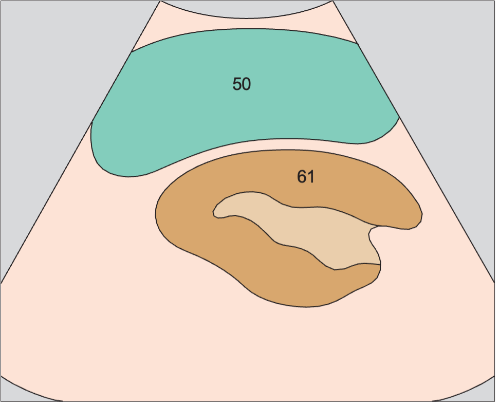 Spleen anatomy diagram, Scan posterior to tail of pancreas, spleen, kidney