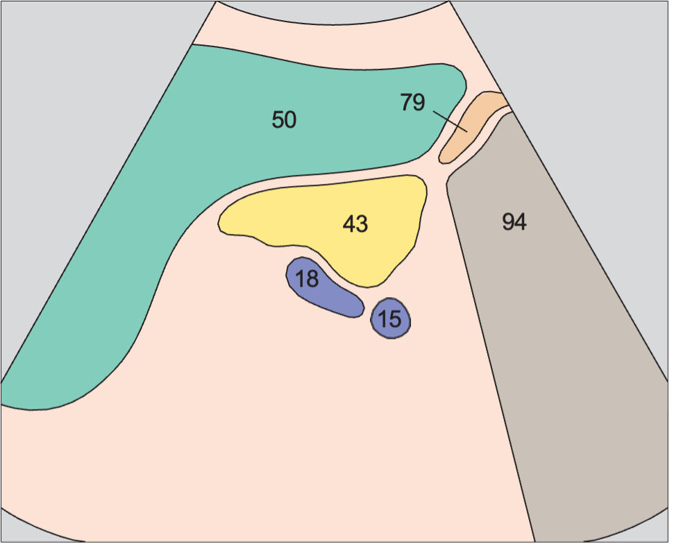 Spleen anatomy diagram, Spleen, tail of pancreas, kidney