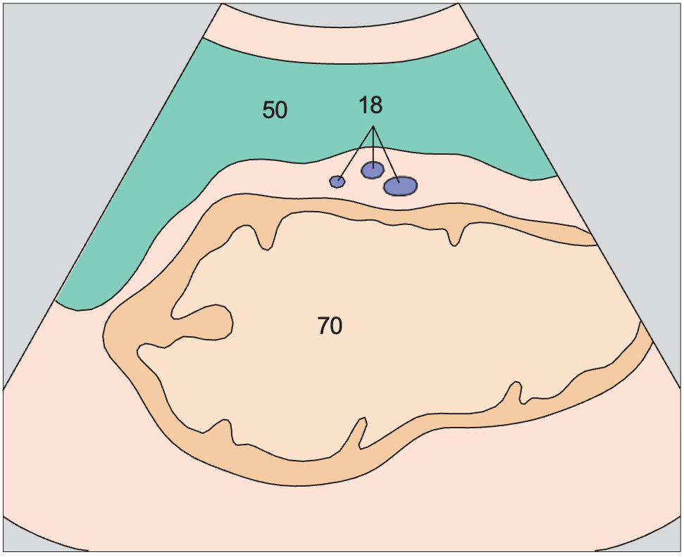 Spleen anatomy diagram, Scan anterior to tail of pancreas, spleen, stomach