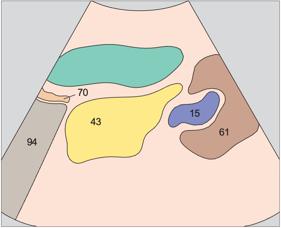 Stomach anatomy diagram, Spleen, tail of pancreas, kidney