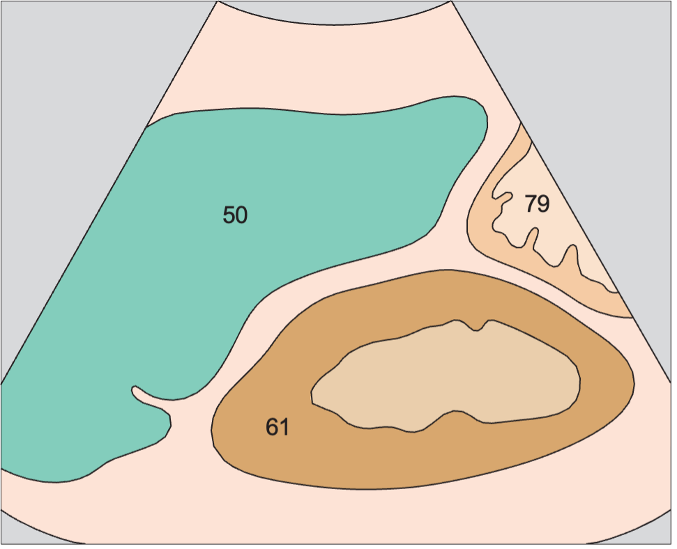 Spleen anatomy diagram, Spleen, kidney