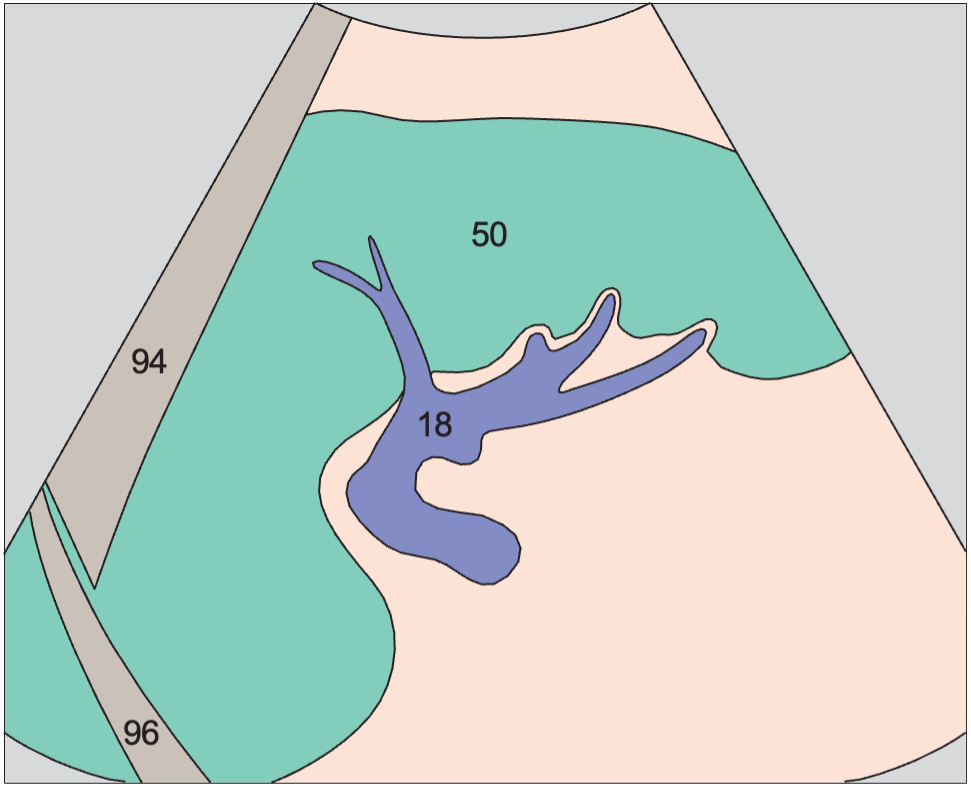 Spleen anatomy diagram, Splenic hilum, splenic vein