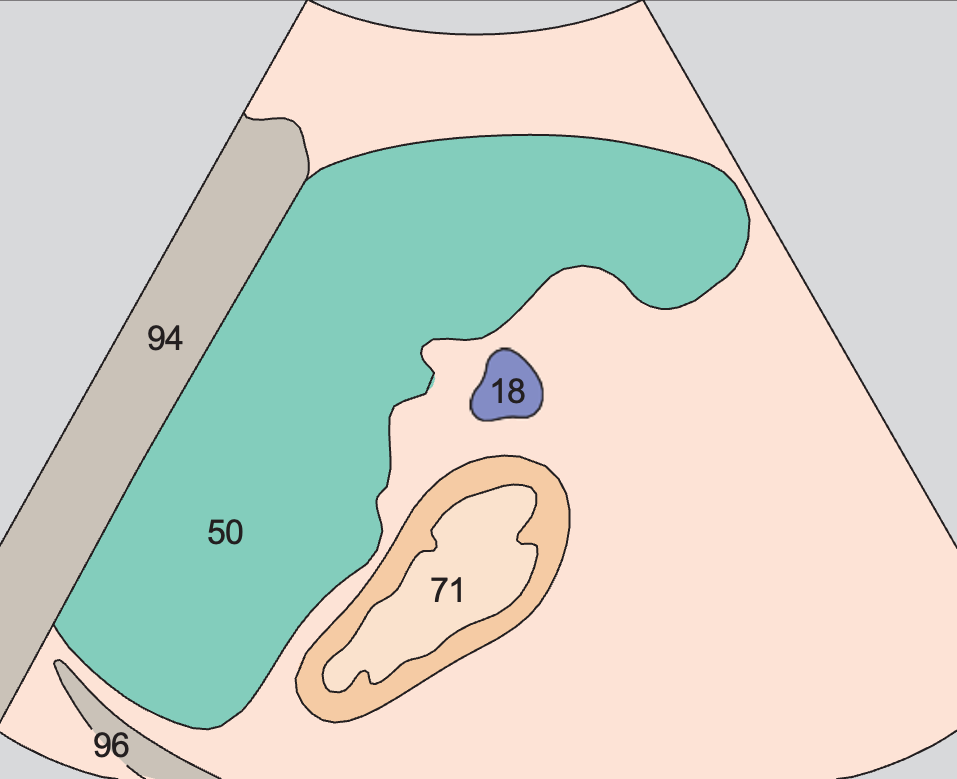 Spleen anatomy diagram, Spleen, stomach