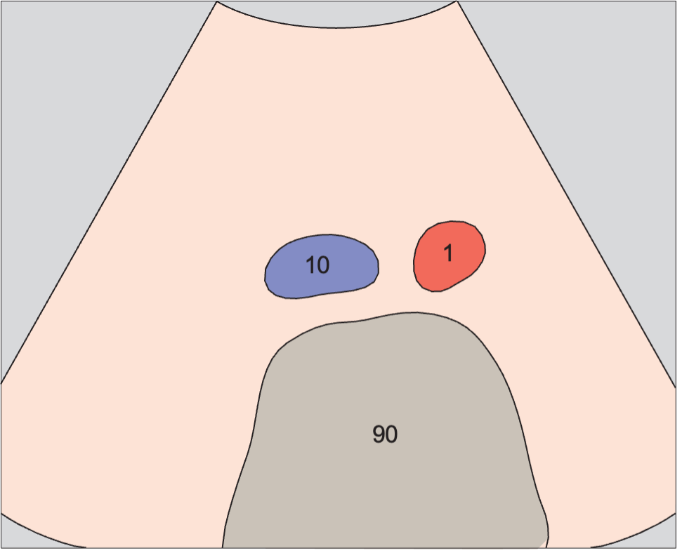 Spinal column anatomy diagram, Infrarenal aorta and vena cava