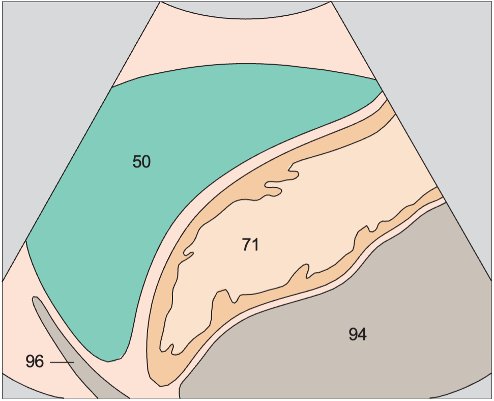 Spleen anatomy diagram, Spleen, stomach