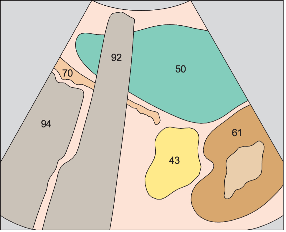 Spleen anatomy diagram, Spleen, kidney, stomach