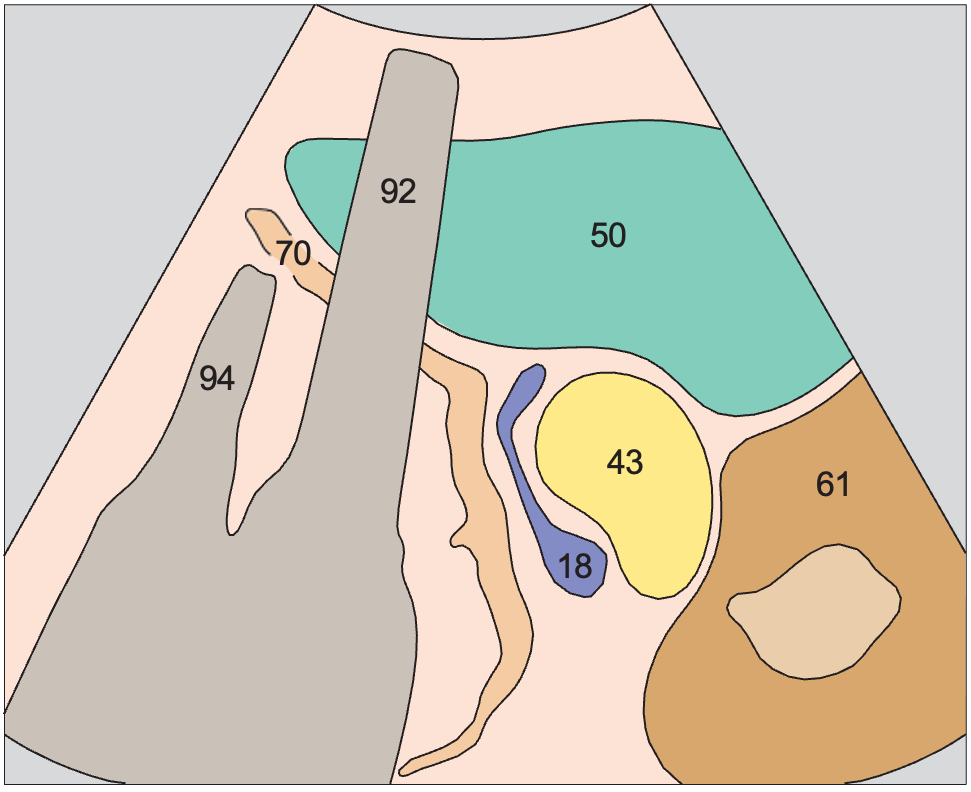 Spleen anatomy diagram, Spleen, kidney, pancreas