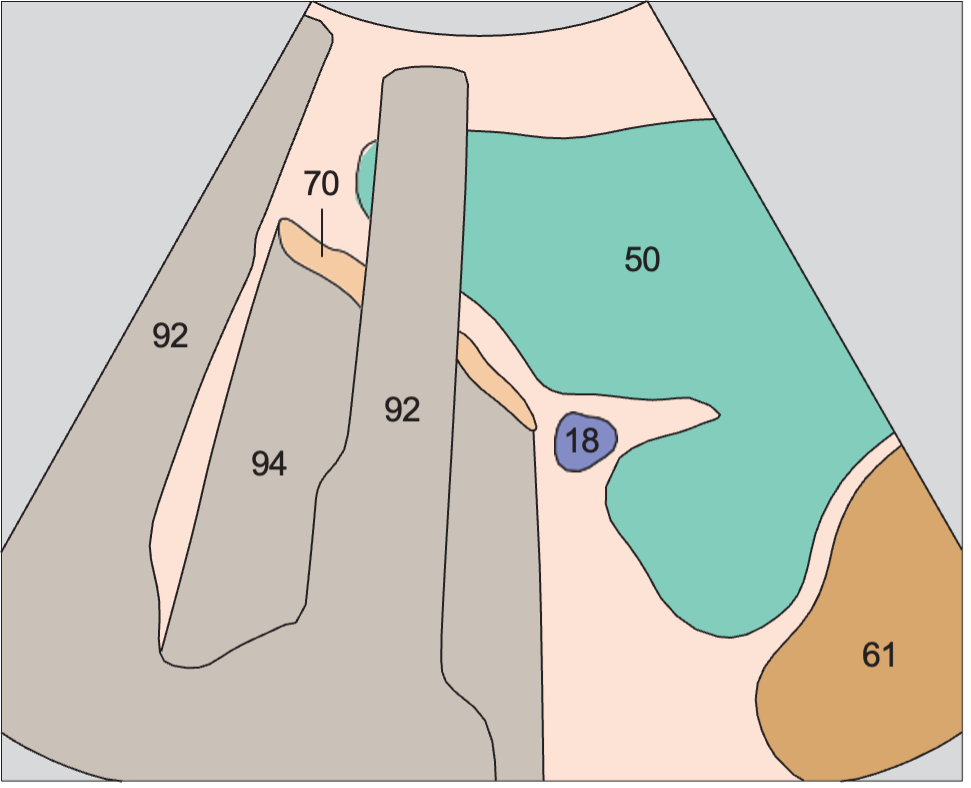 Spleen anatomy diagram, Spleen, stomach