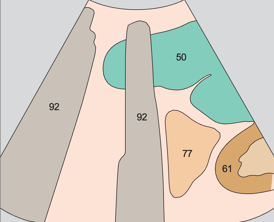 Spleen anatomy diagram, Spleen, small bowel
