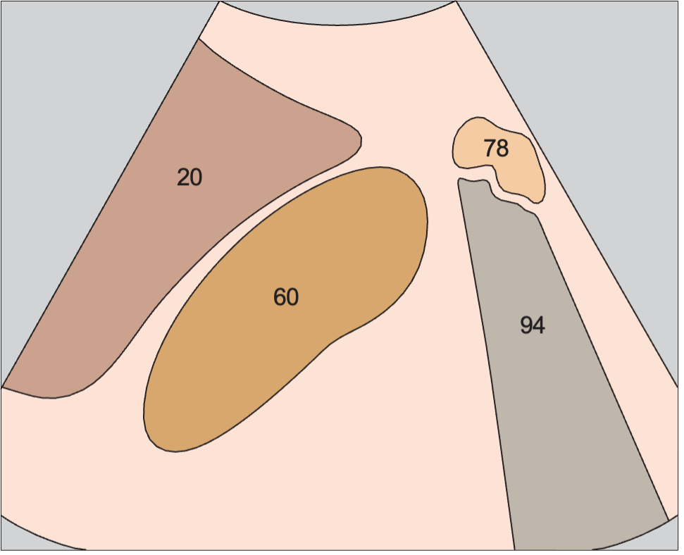 Right kidney anatomy diagram, Kidney, liver