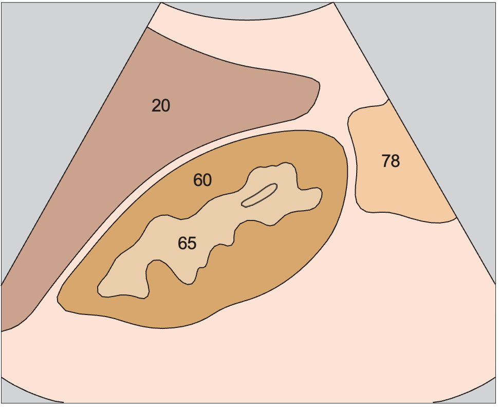 Right kidney anatomy diagram, Kidney, liver, colic flexure