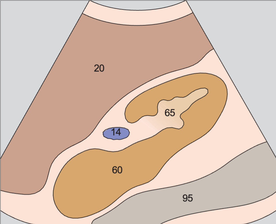Right kidney anatomy diagram, Kidney, renal vein, liver