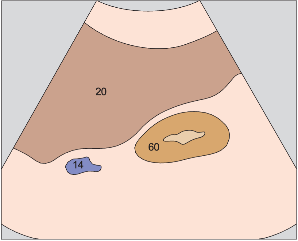 Right kidney anatomy diagram, Kidney, renal vein, liver
