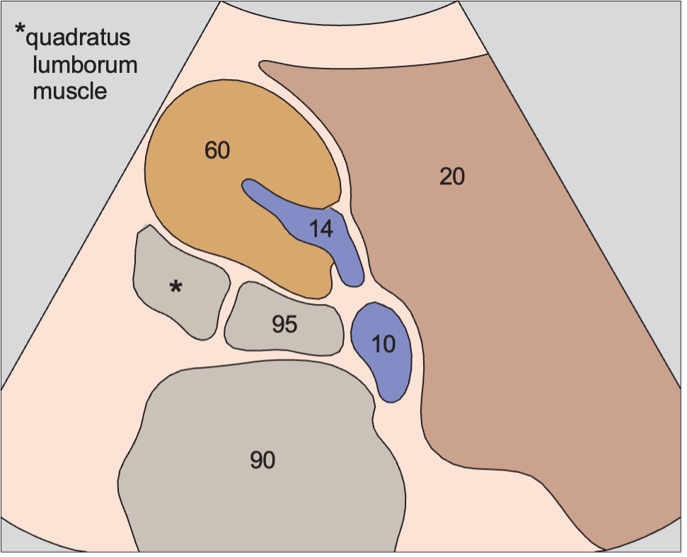 Right kidney anatomy diagram, Kidney, liver, psoas muscle, quadratus lumborum muscle