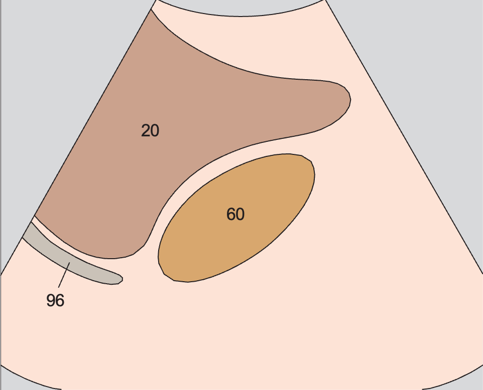 Right kidney anatomy diagram, Kidney, liver